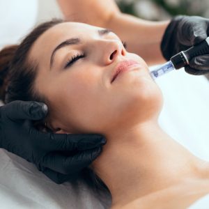 micro needling pen facial