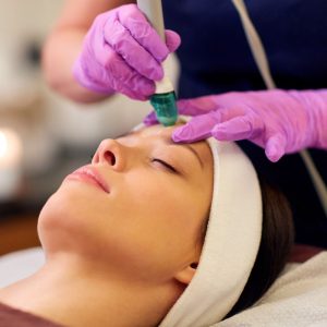 Hydra Oxygen Microdermabrasion